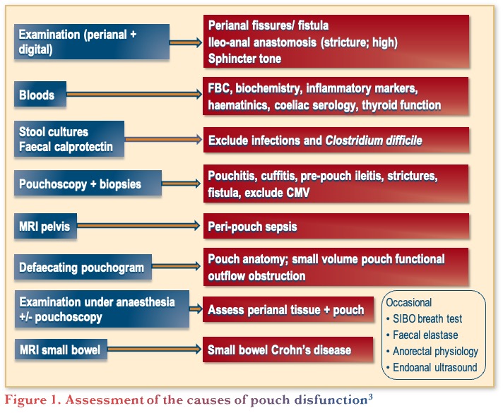 Assessment of the causes of pouch dysfunction